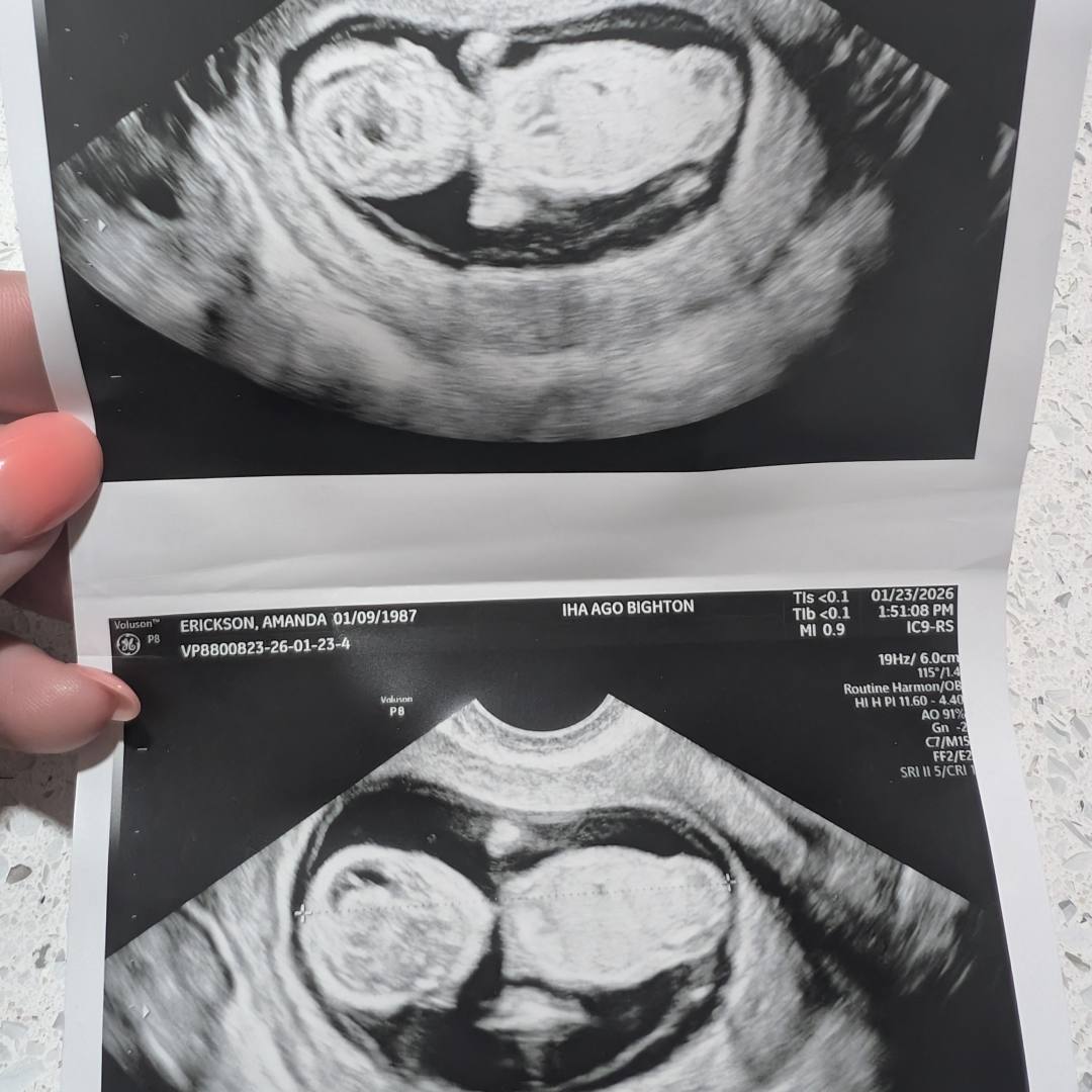 Photo shared by Amanda for their Babylist baby registry.