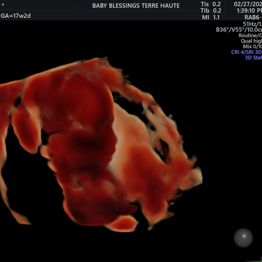 Photo shared by Hannah for their Babylist baby registry.