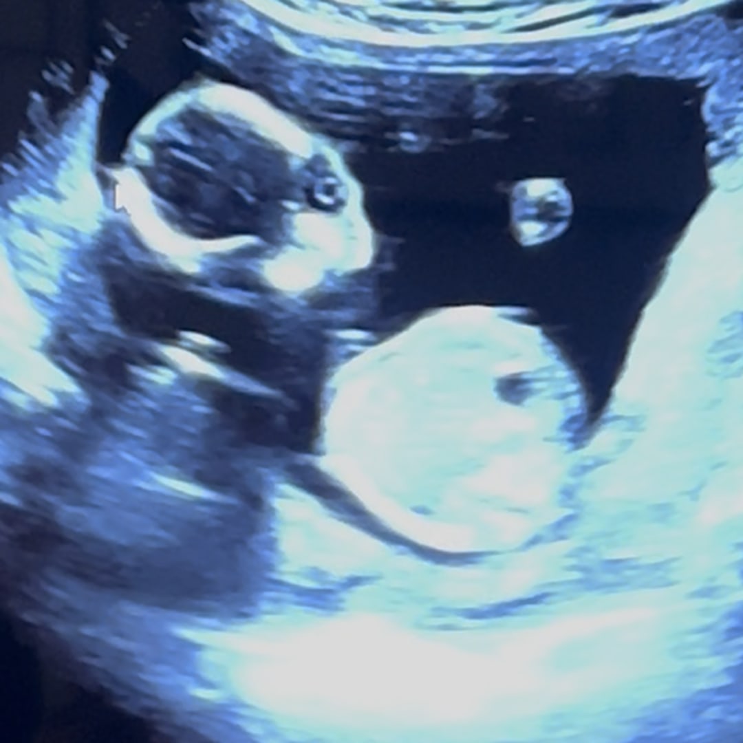 Photo shared by Cristina for their Babylist baby registry.