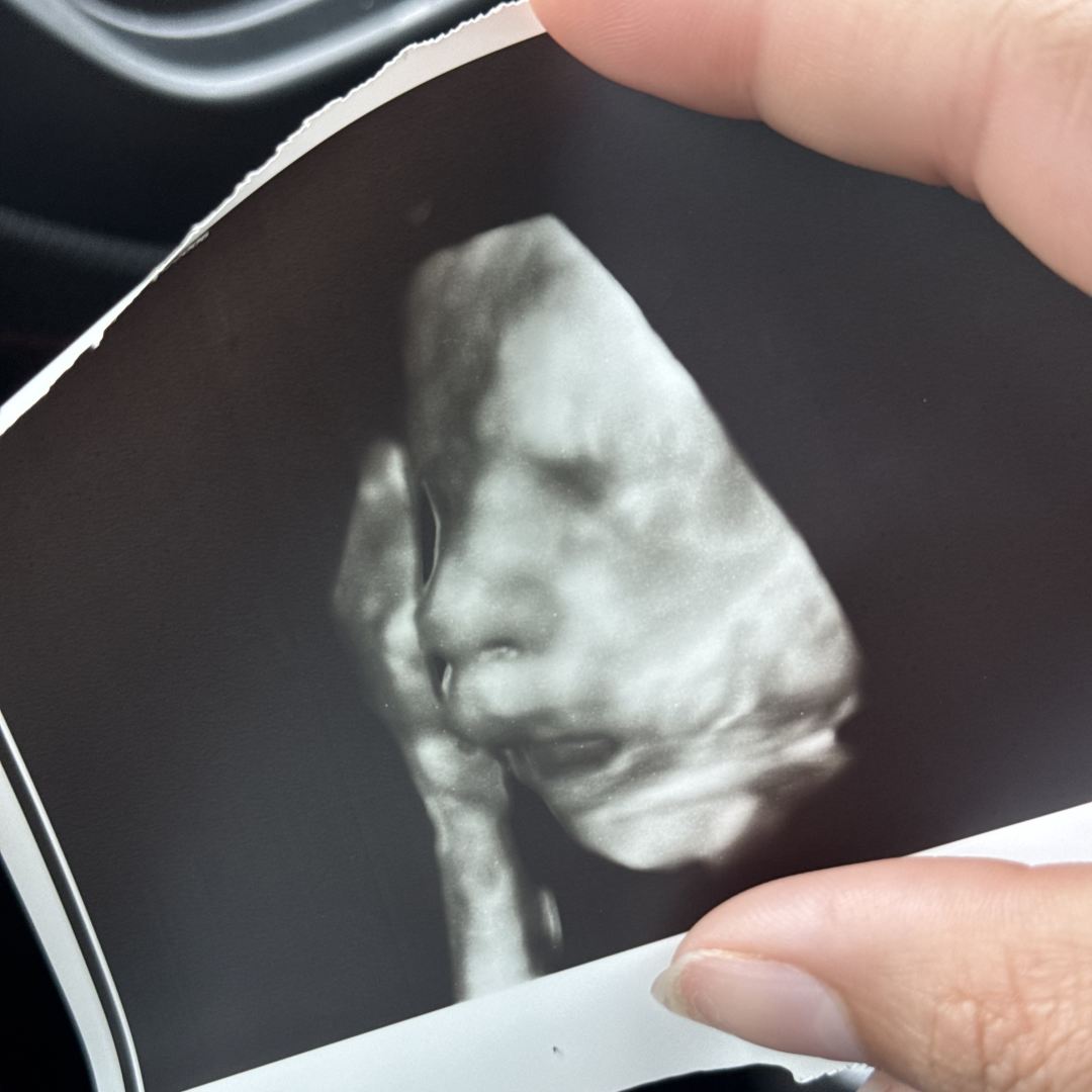 Photo shared by Gloria for their Babylist baby registry.