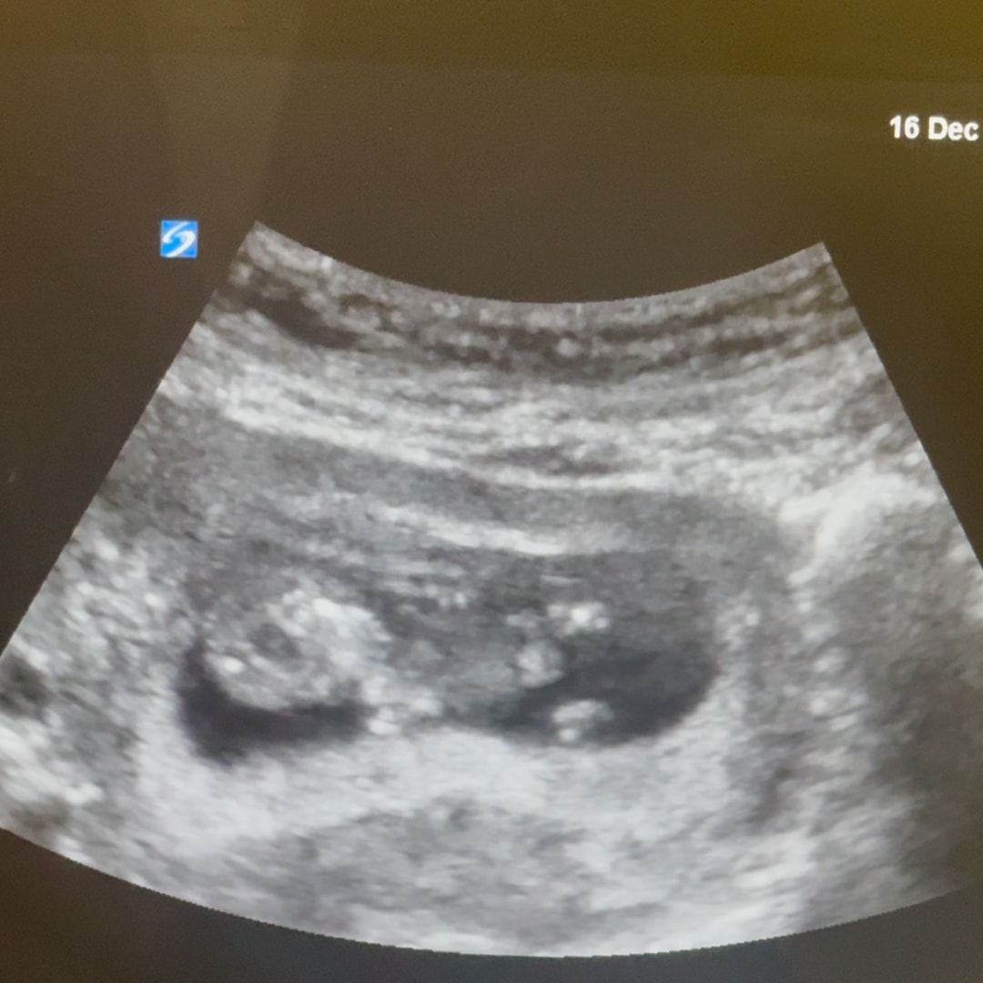 Photo shared by Erika for their Babylist baby registry.