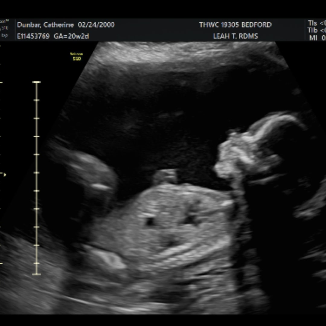 Photo shared by Cat for their Babylist baby registry.