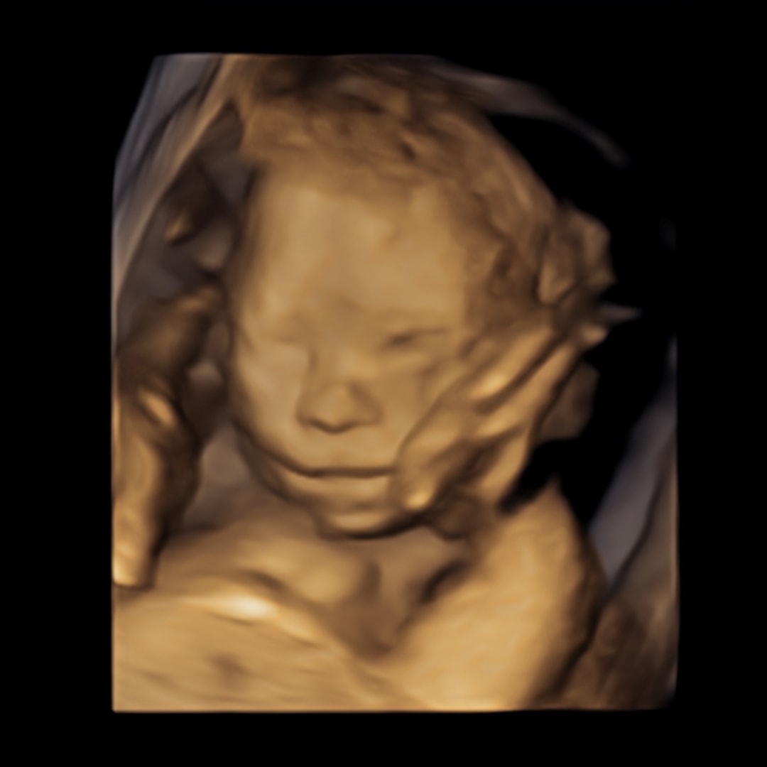 Photo shared by Brooke for their Babylist baby registry.