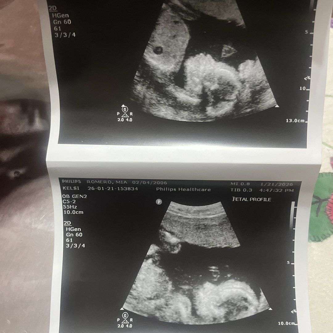 Photo shared by Mia for their Babylist baby registry.