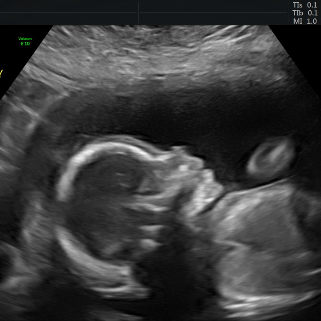 Photo shared by Ellie for their Babylist baby registry.