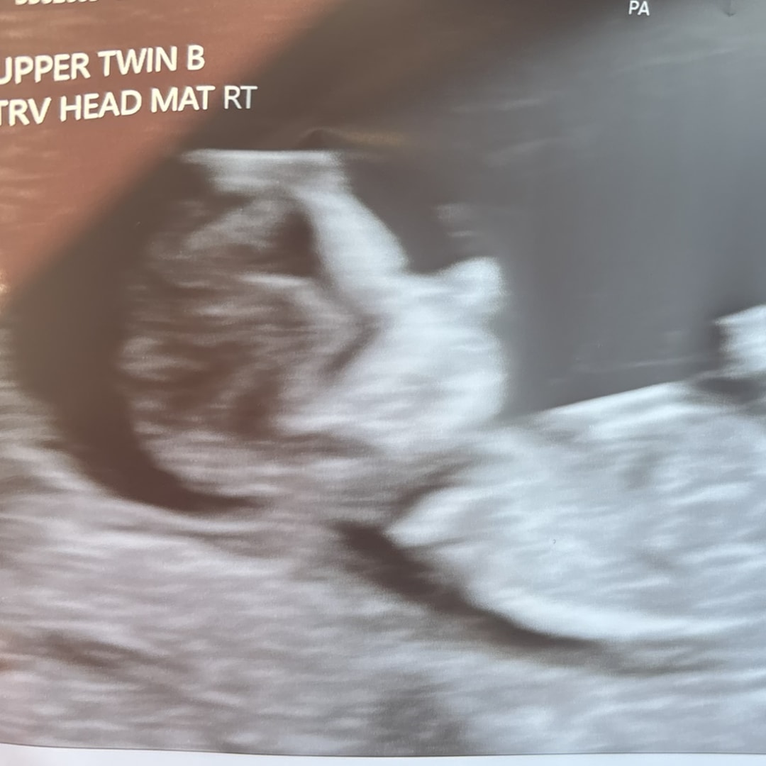 Photo shared by Zuleyma for their Babylist baby registry.