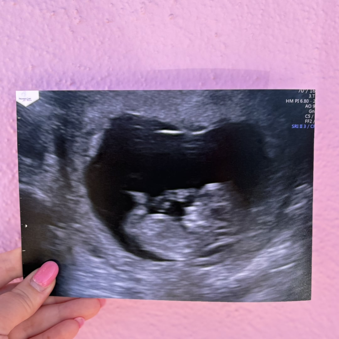 Photo shared by Alexis for their Babylist baby registry.