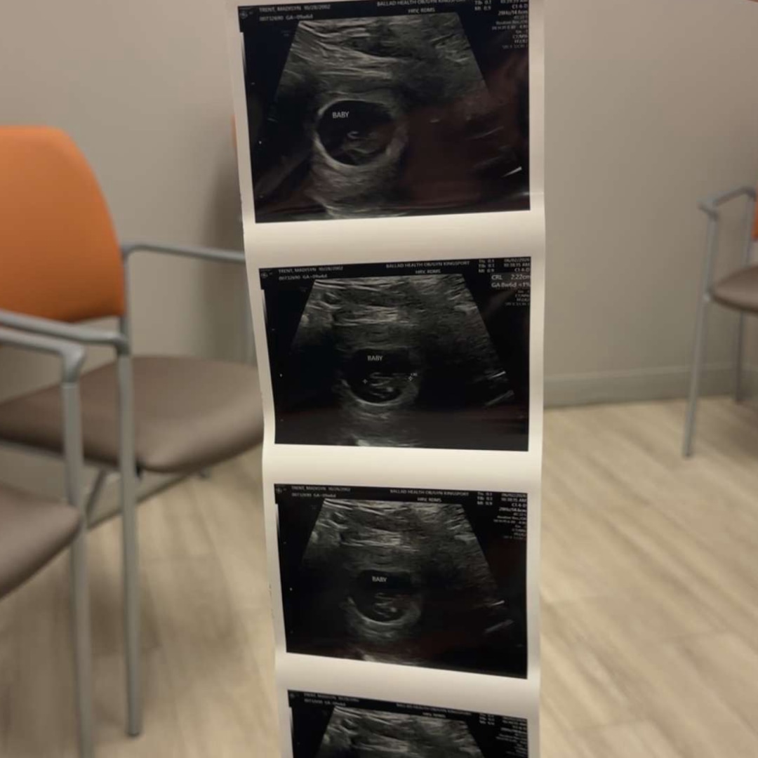 Photo shared by Madisyn for their Babylist baby registry.