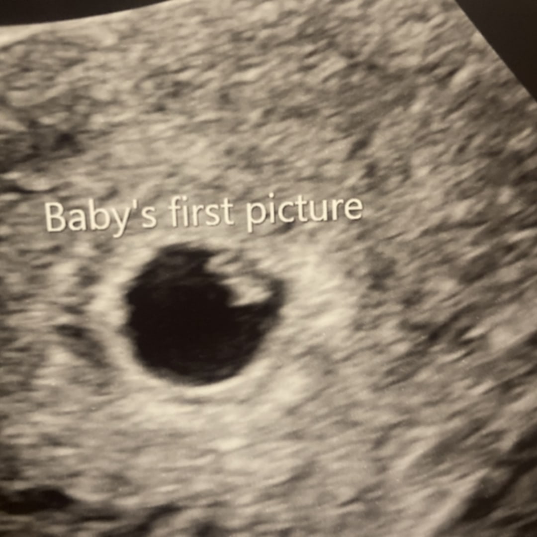 Photo shared by Kenesha for their Babylist baby registry.