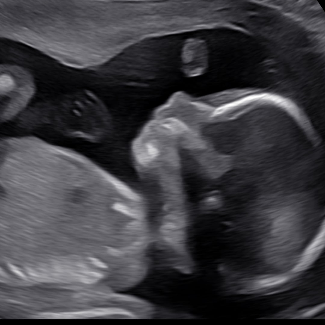 Photo shared by Ashlee & Jonathon for their Babylist baby registry.