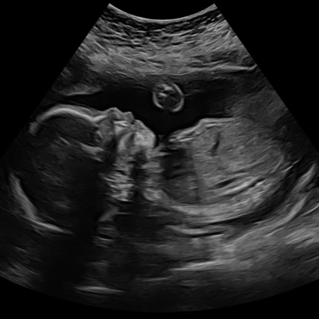 Photo shared by Maibelyn for their Babylist baby registry.
