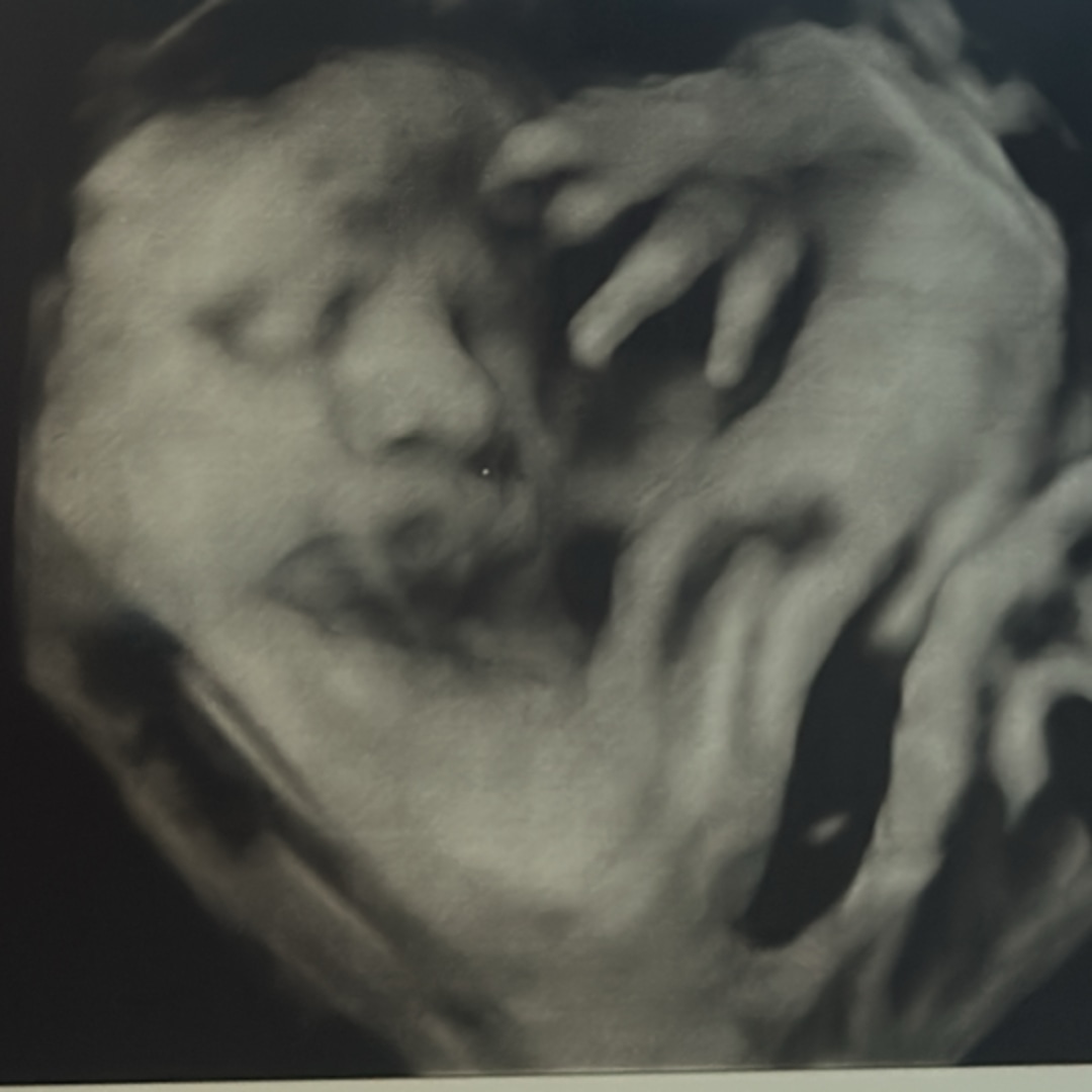 Photo shared by Deborah for their Babylist baby registry.