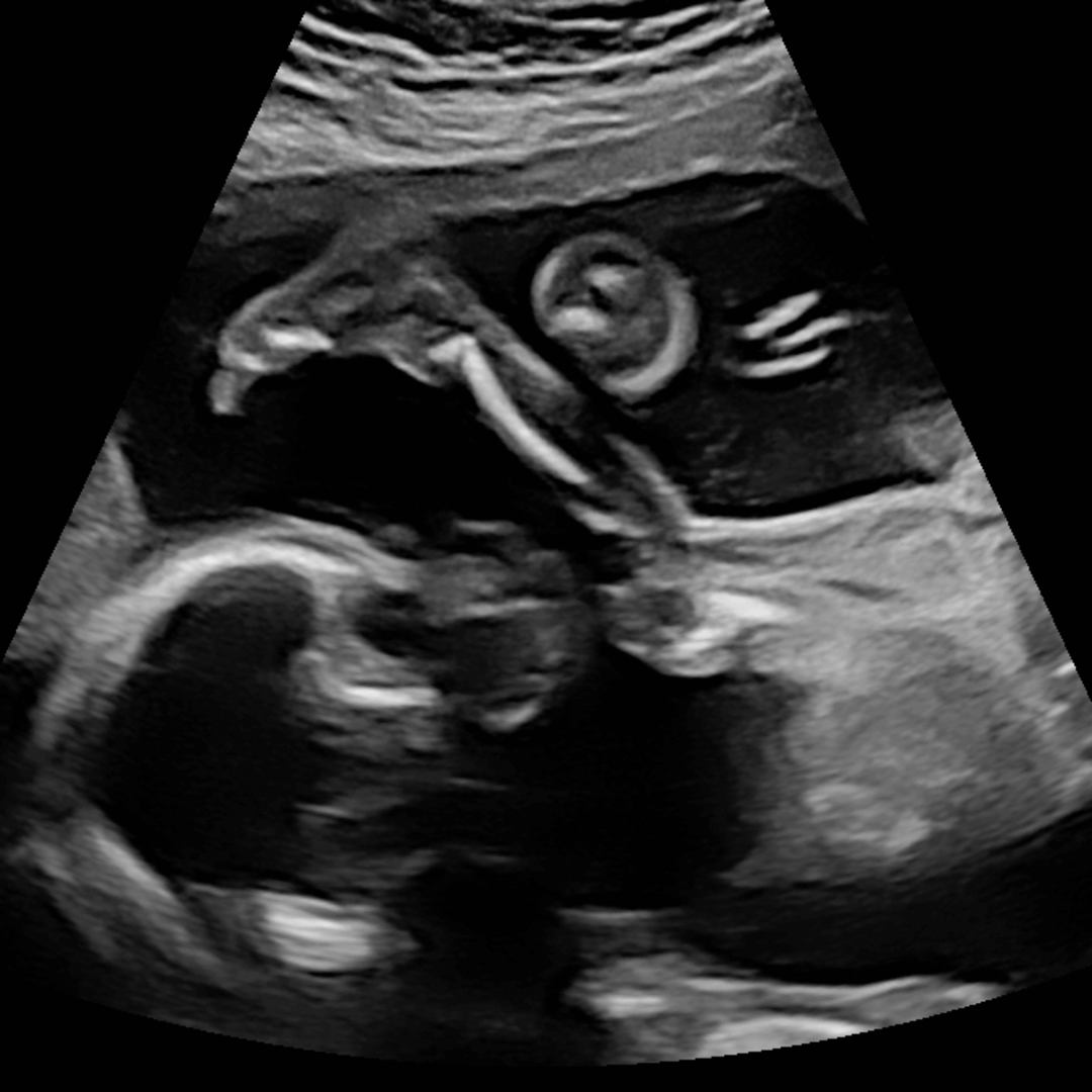 Photo shared by Gabbi for their Babylist baby registry.