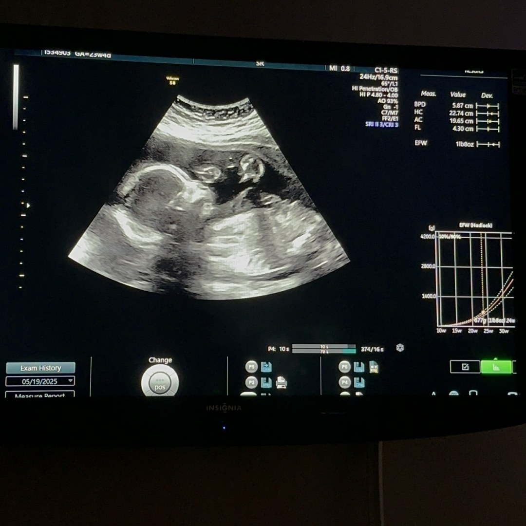 Photo shared by Brianna for their Babylist baby registry.