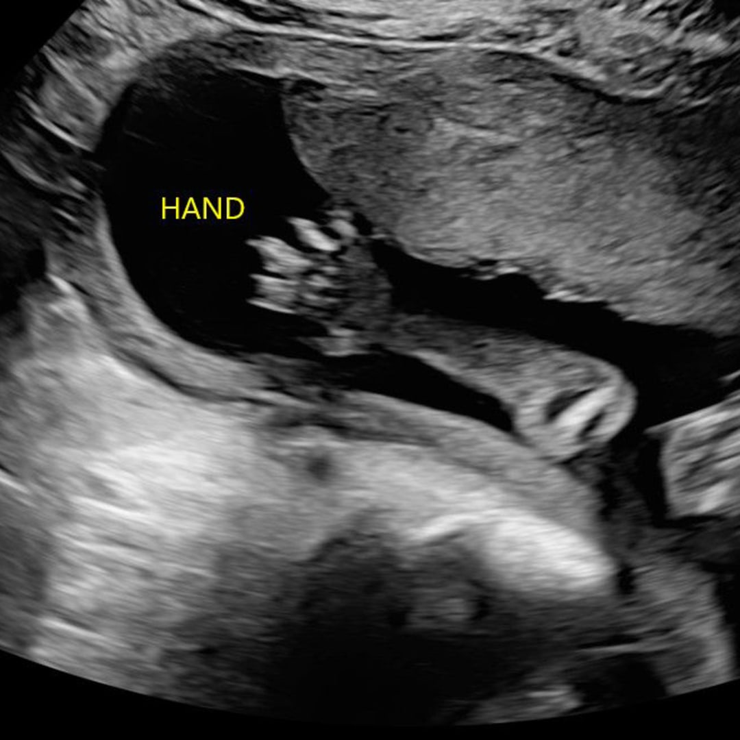 Photo shared by Bria for their Babylist baby registry.