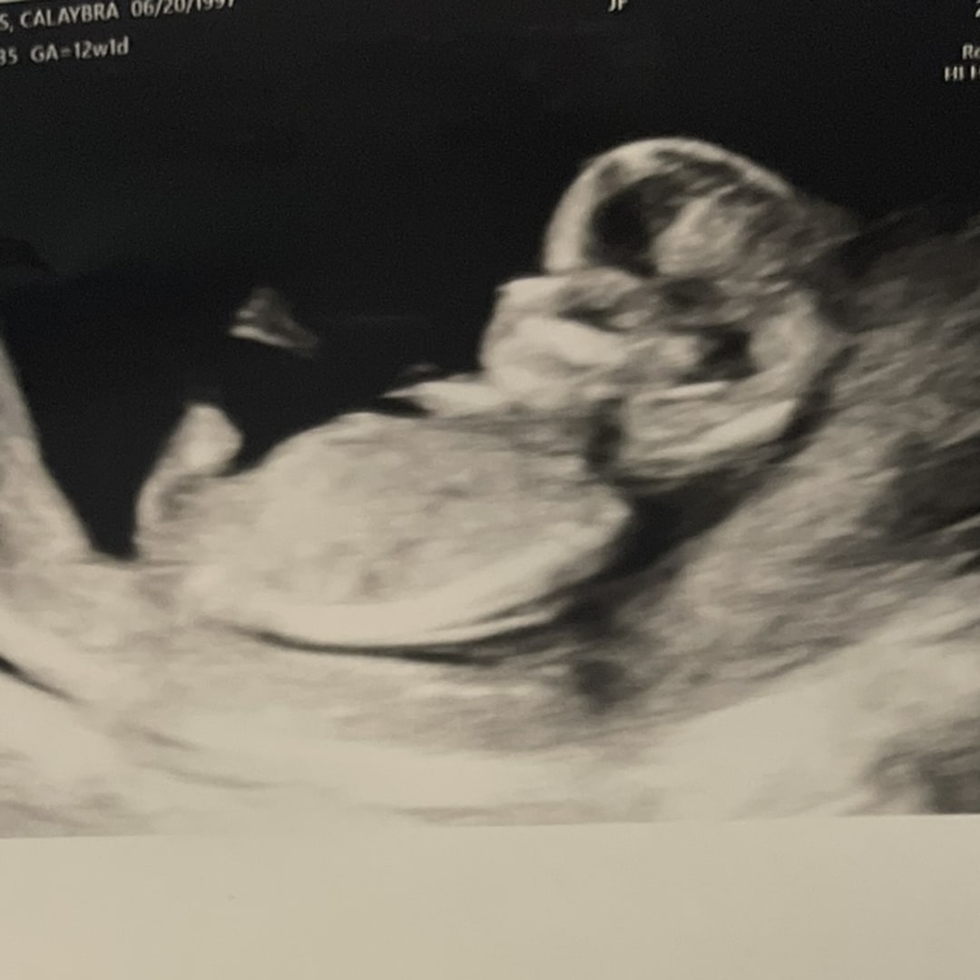 Photo shared by Calaybra for their Babylist baby registry.