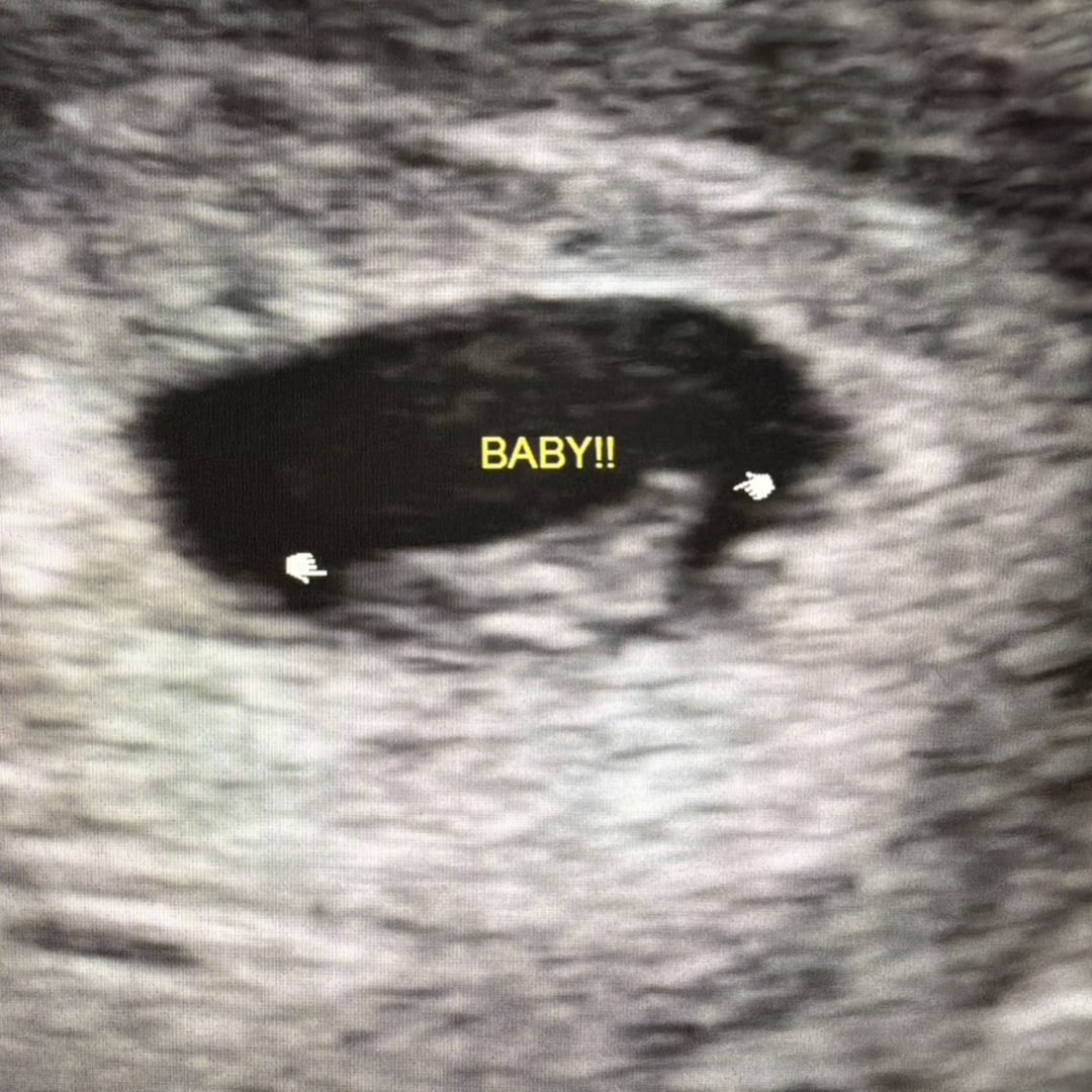 Photo shared by Haley for their Babylist baby registry.
