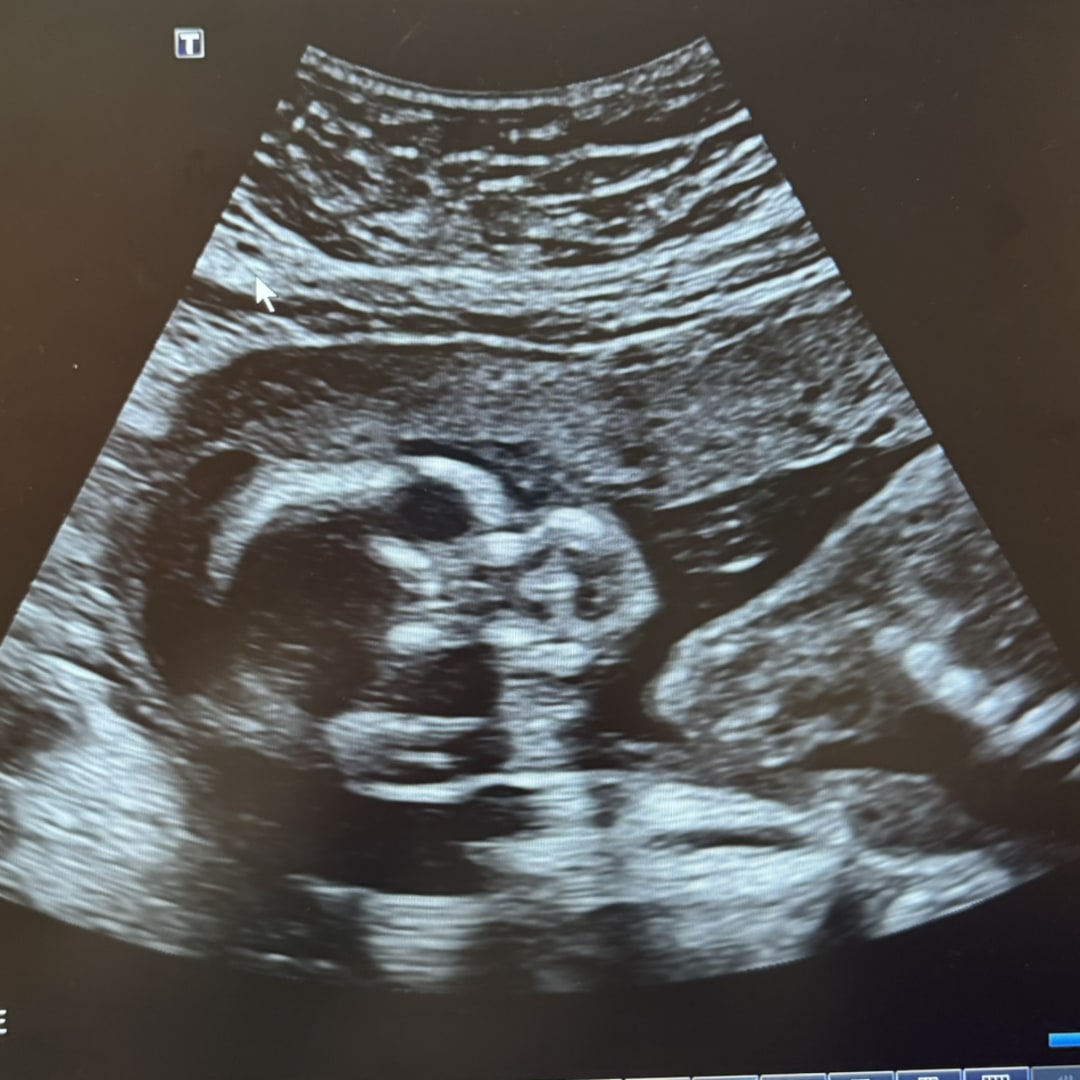 Photo shared by Nora for their Babylist baby registry.