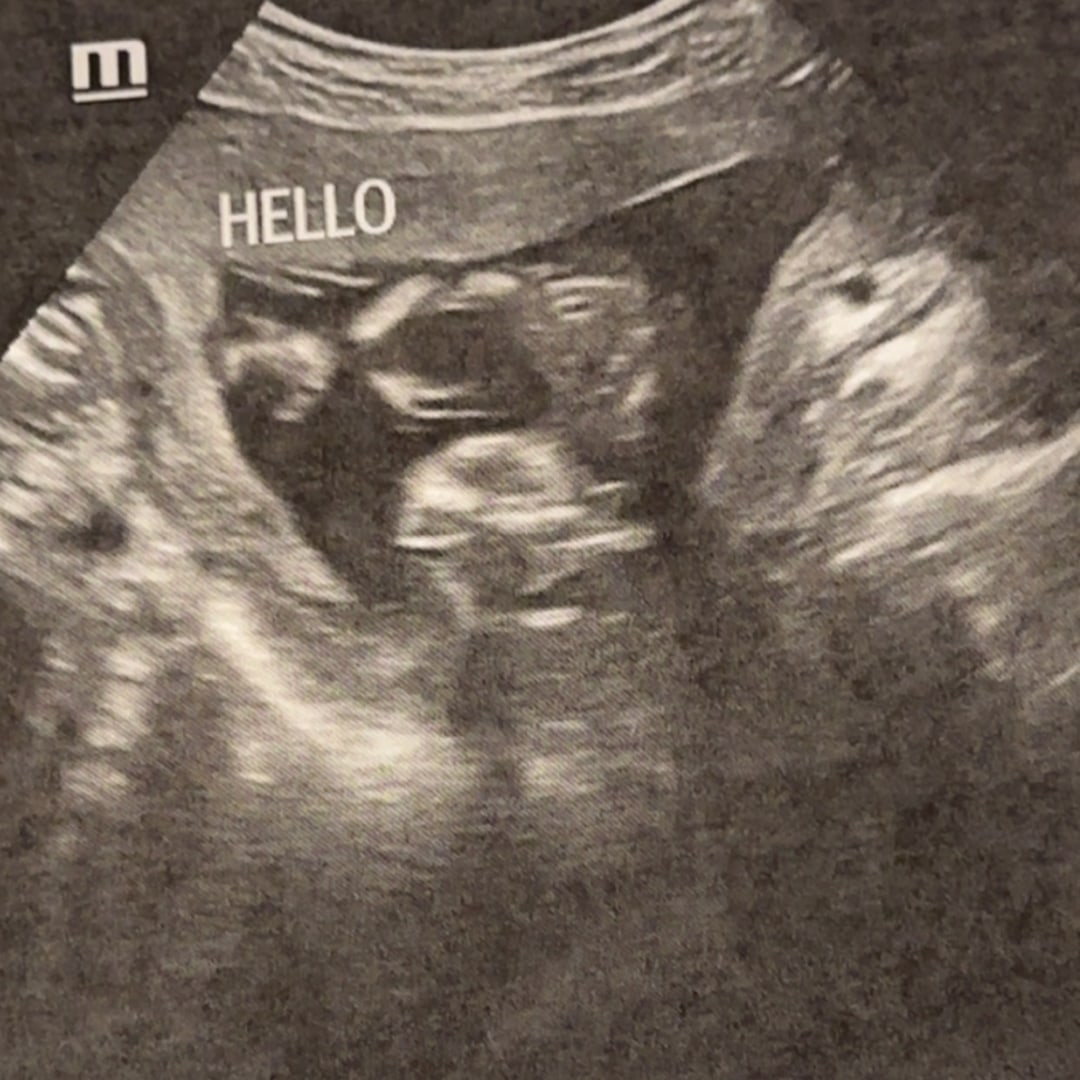 Photo shared by Becca for their Babylist baby registry.