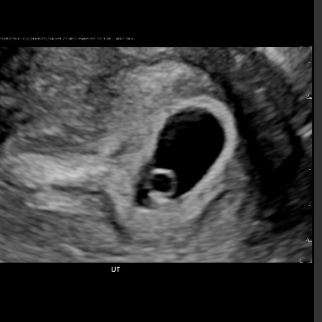 Photo shared by Elachye for their Babylist baby registry.