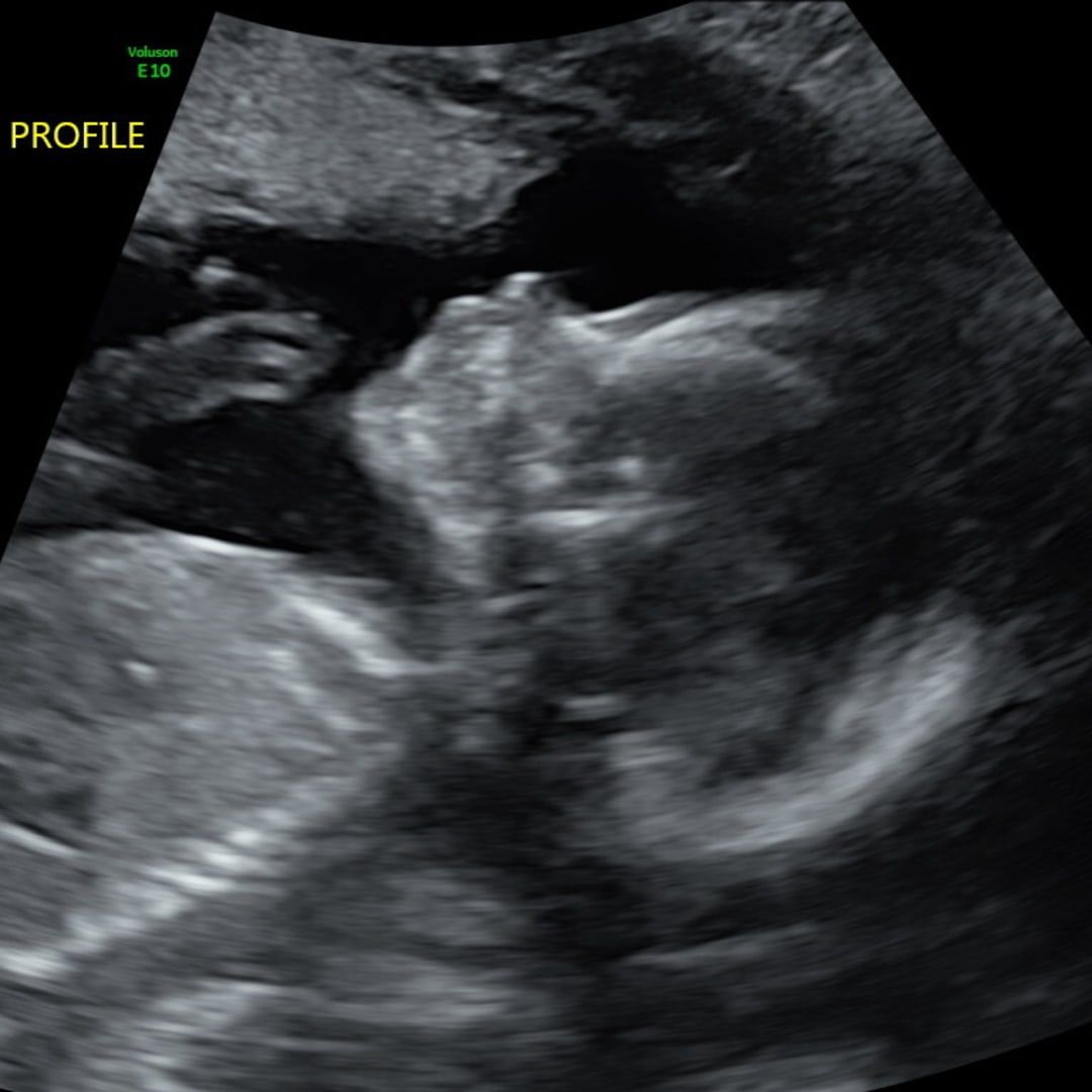 Photo shared by Jasmine for their Babylist baby registry.