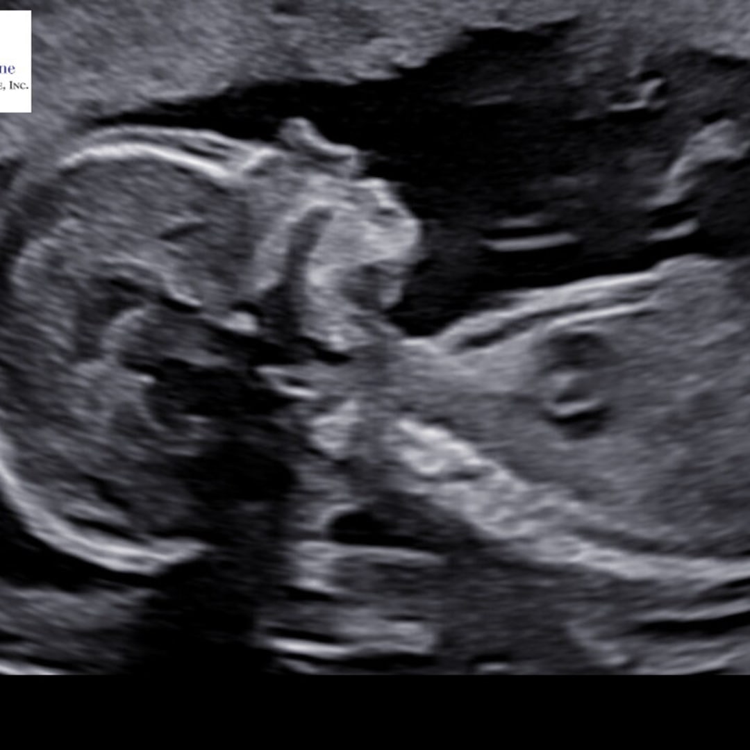 Photo shared by Sarah for their Babylist baby registry.