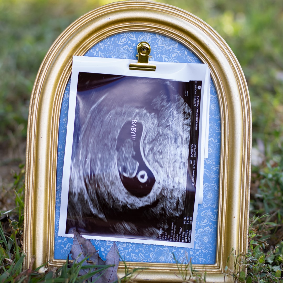 Photo shared by Chloe for their Babylist baby registry.