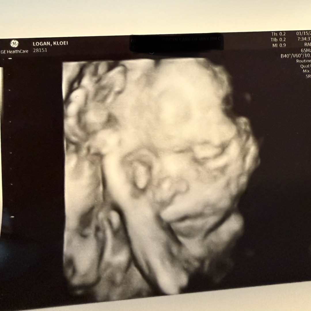 Photo shared by Kloei for their Babylist baby registry.