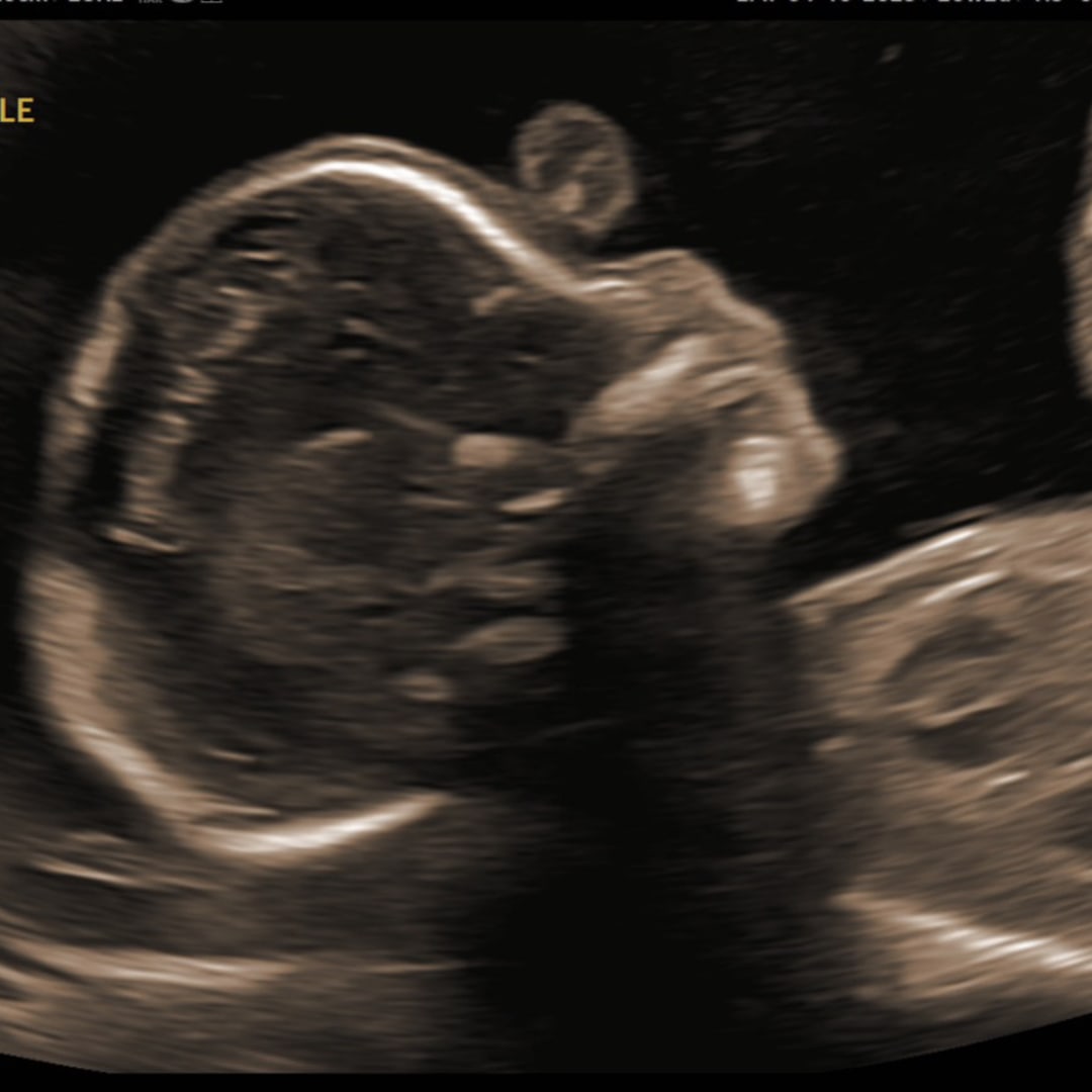 Photo shared by Brianna Mejia for their Babylist baby registry.