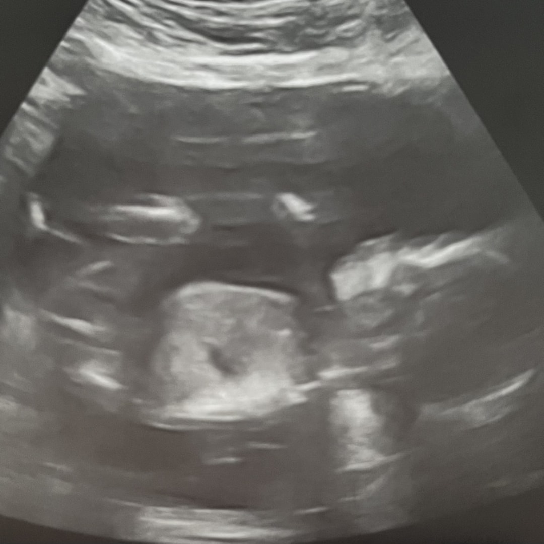 Photo shared by Sylvii for their Babylist baby registry.