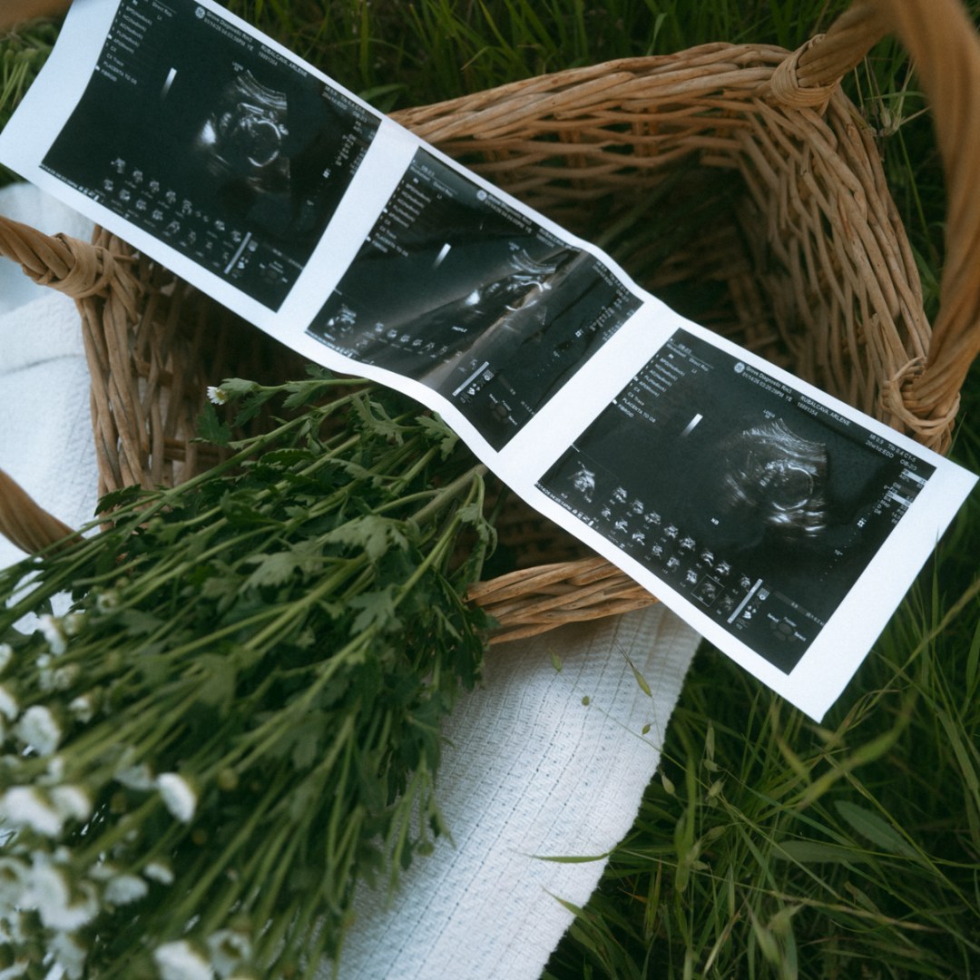 Photo shared by Arlene for their Babylist baby registry.