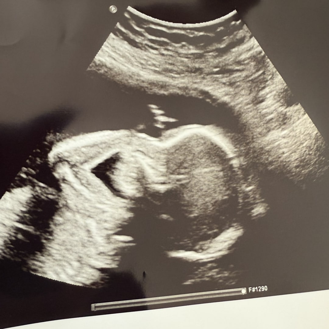 Photo shared by Emily for their Babylist baby registry.