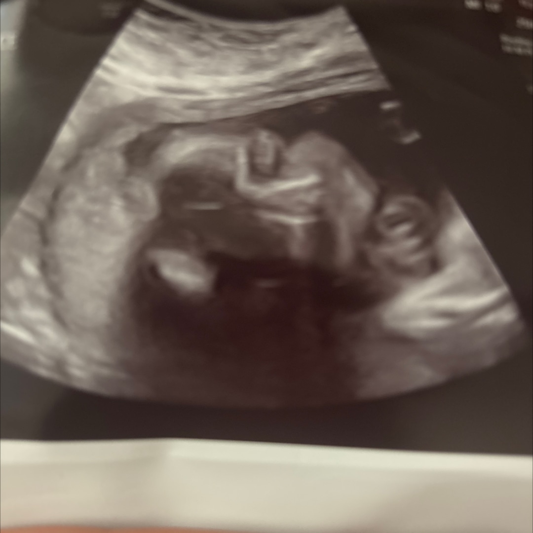 Photo shared by Isabella for their Babylist baby registry.