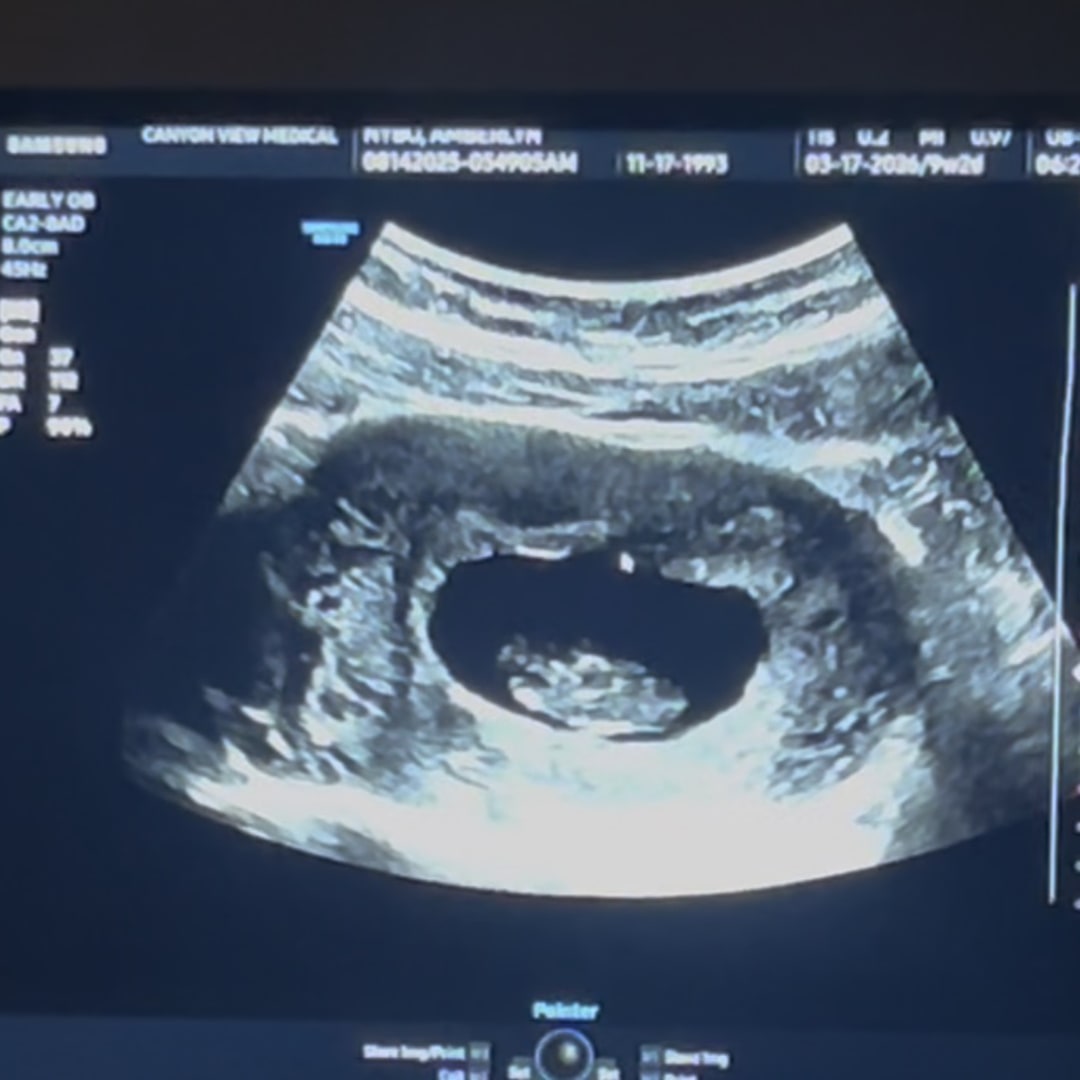 Photo shared by Amberlyn for their Babylist baby registry.