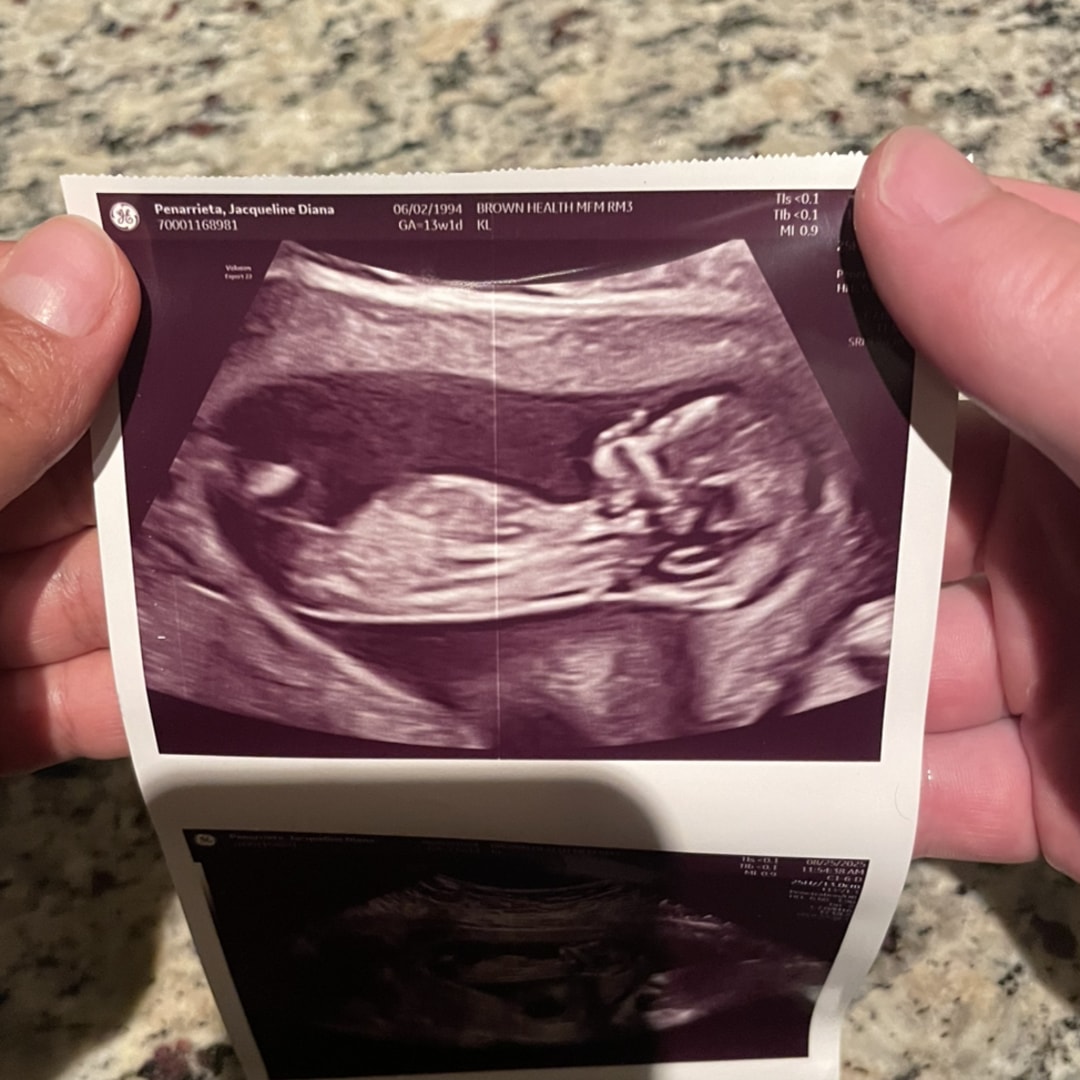 Photo shared by Jacqueline for their Babylist baby registry.