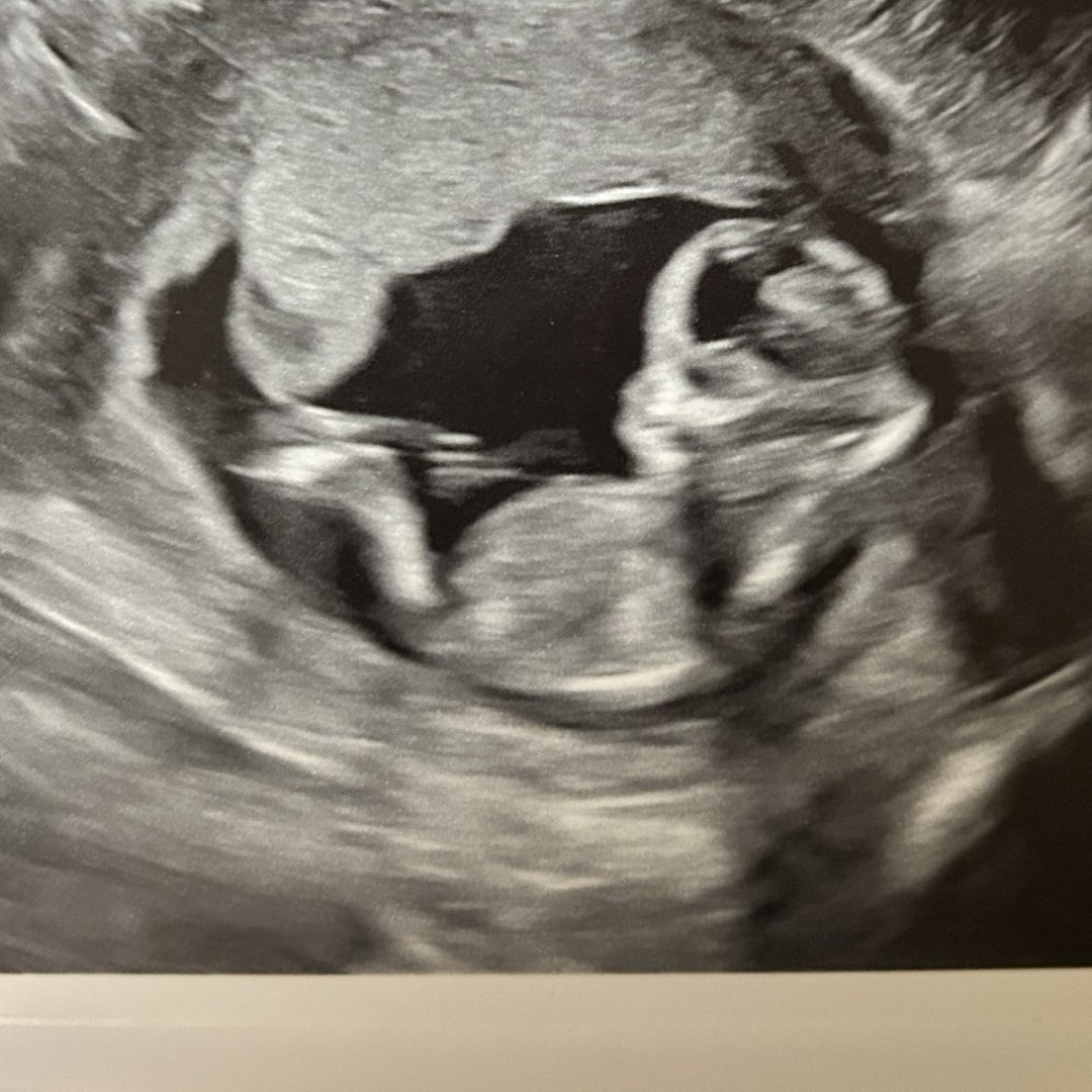 Photo shared by Felicia for their Babylist baby registry.