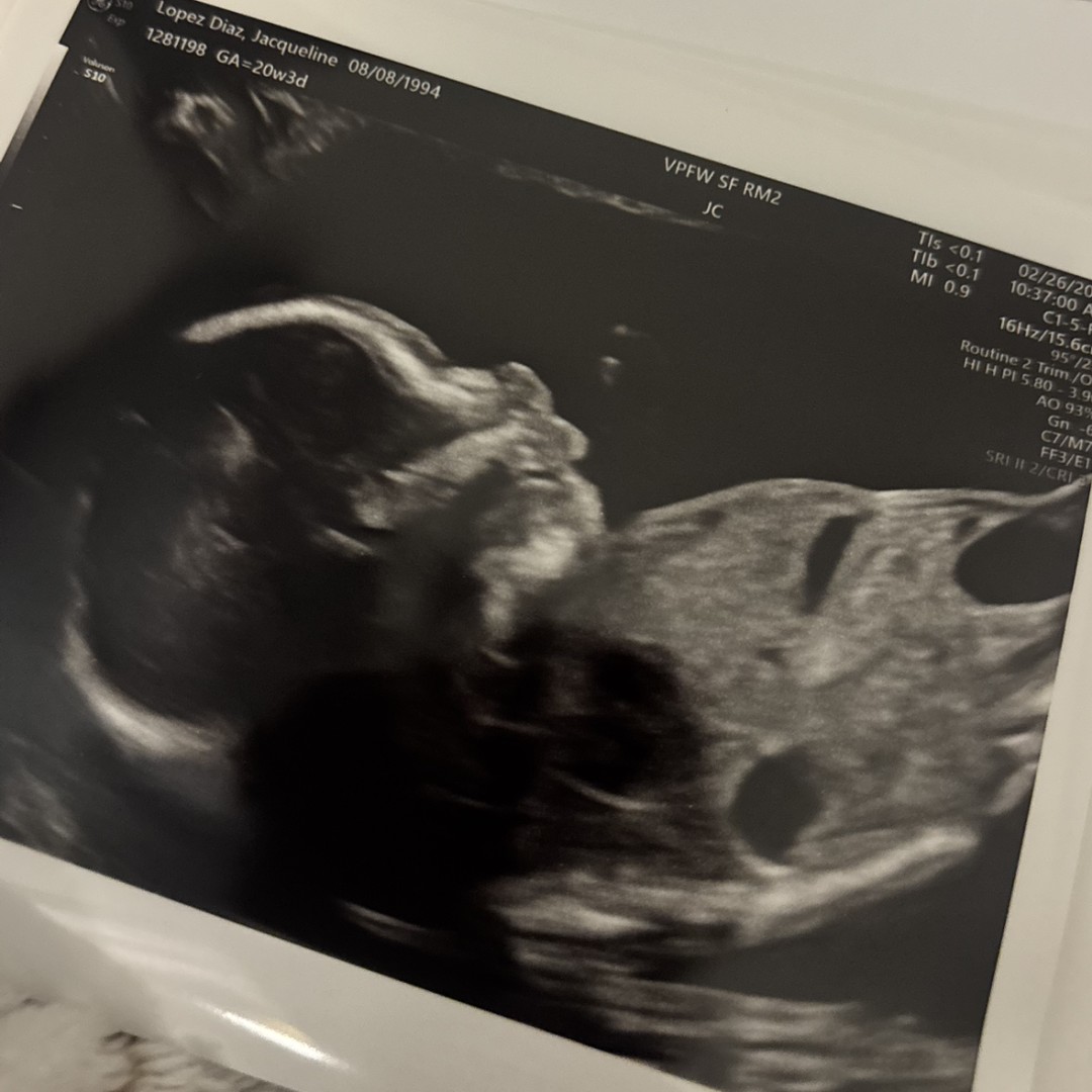 Photo shared by Jacqueline for their Babylist baby registry.