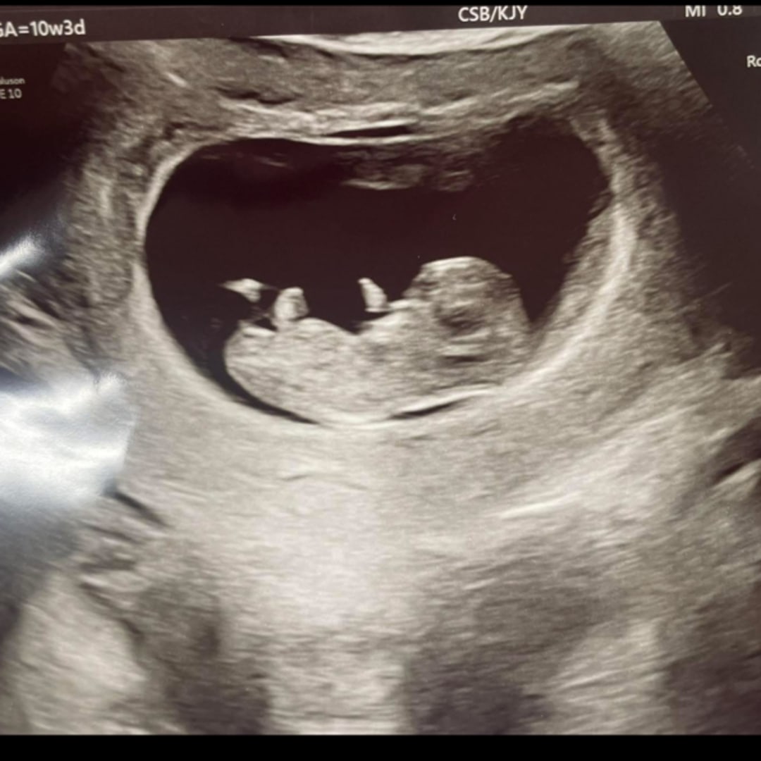 Photo shared by Marissa for their Babylist baby registry.