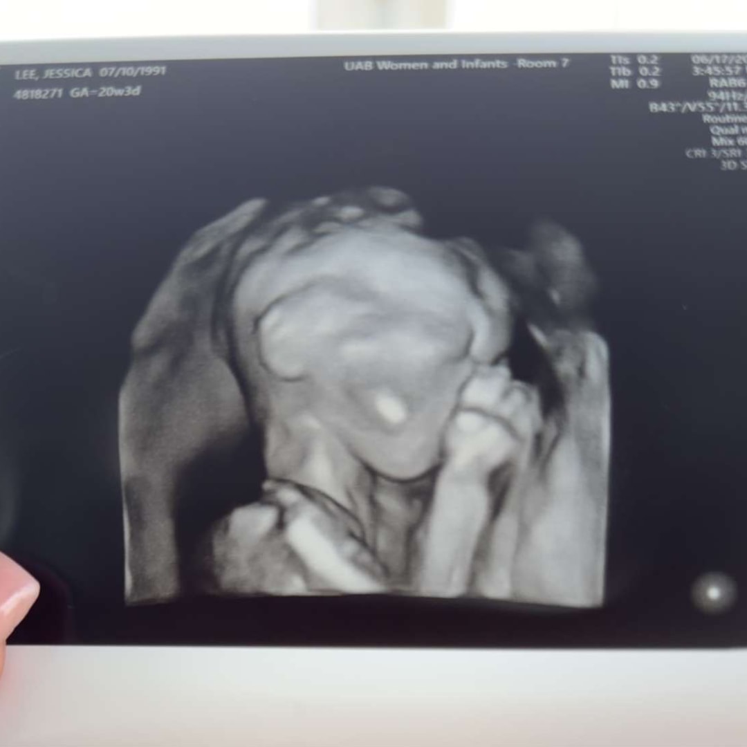 Photo shared by Jessics for their Babylist baby registry.