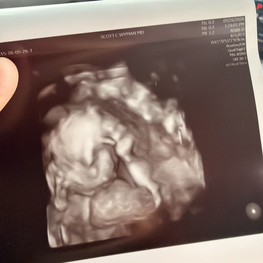 Photo shared by Mariah&Arlyn for their Babylist baby registry.