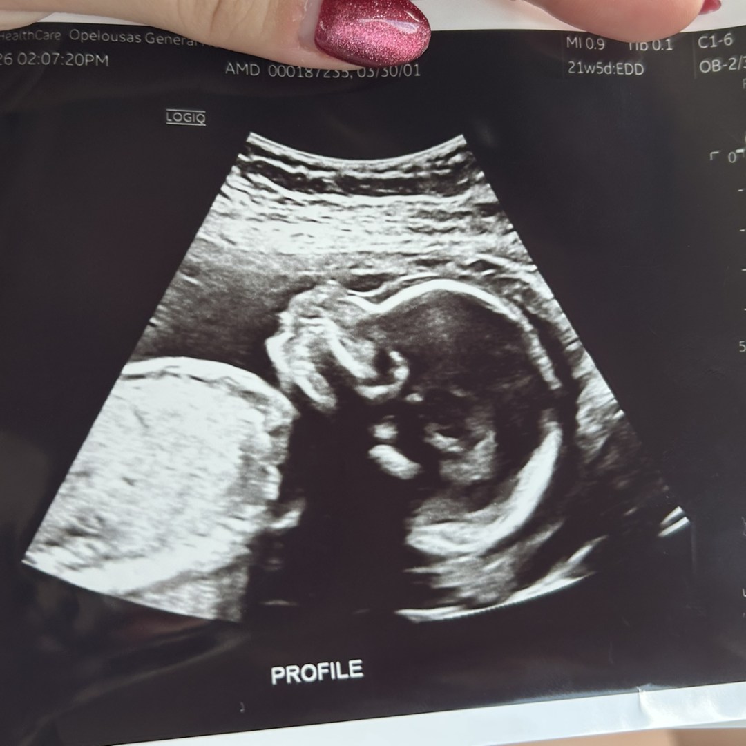 Photo shared by Destiny for their Babylist baby registry.