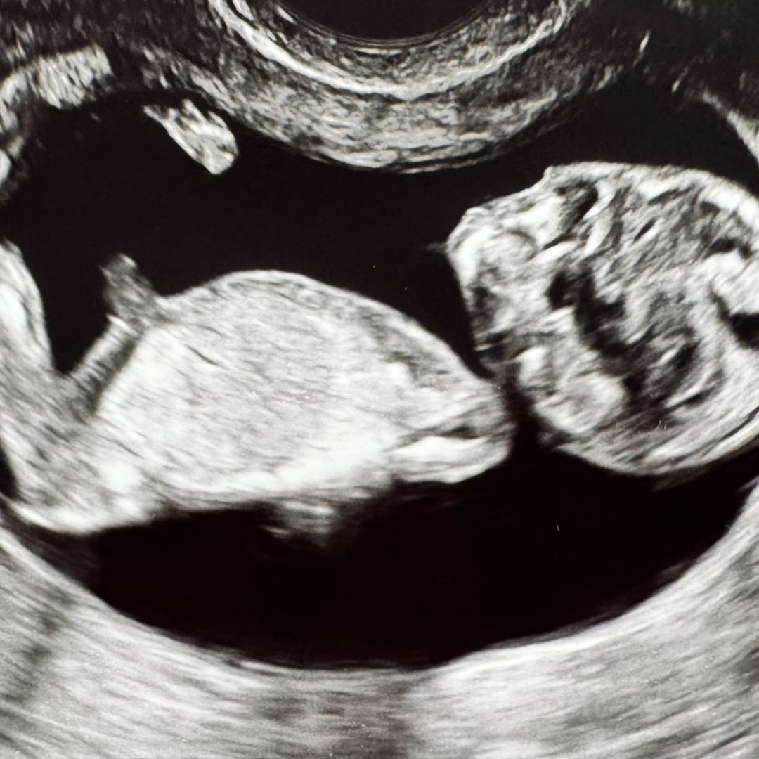 Photo shared by Amanda for their Babylist baby registry.