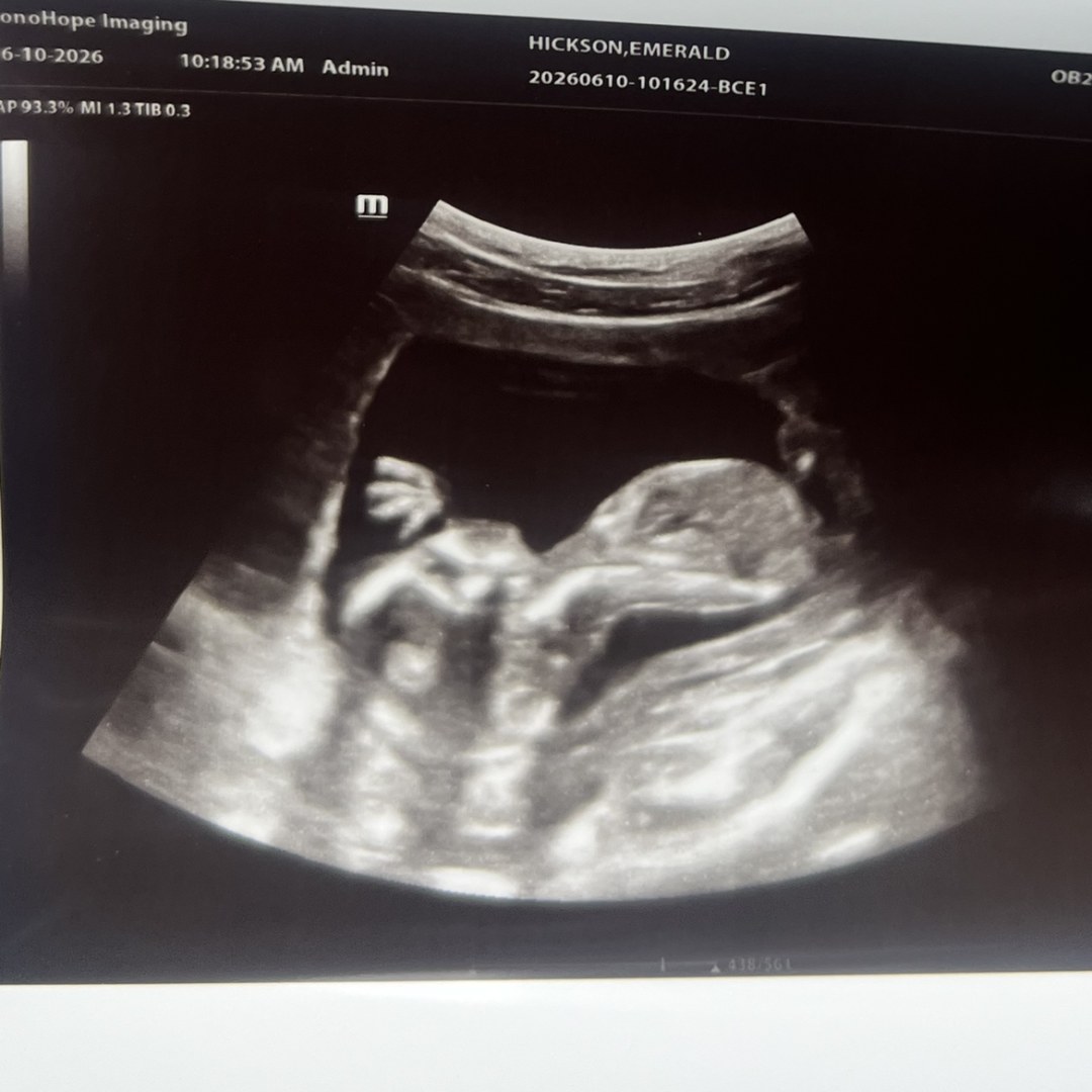 Photo shared by Emerald for their Babylist baby registry.