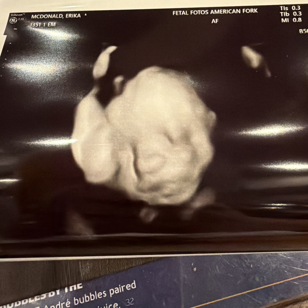 Photo shared by Erika for their Babylist baby registry.