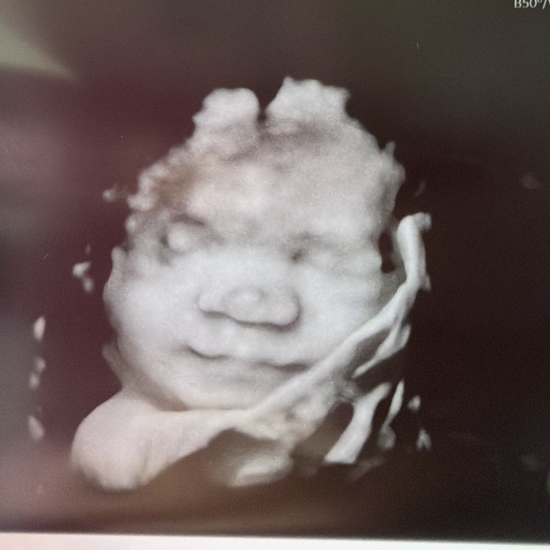 Photo shared by Haley for their Babylist baby registry.