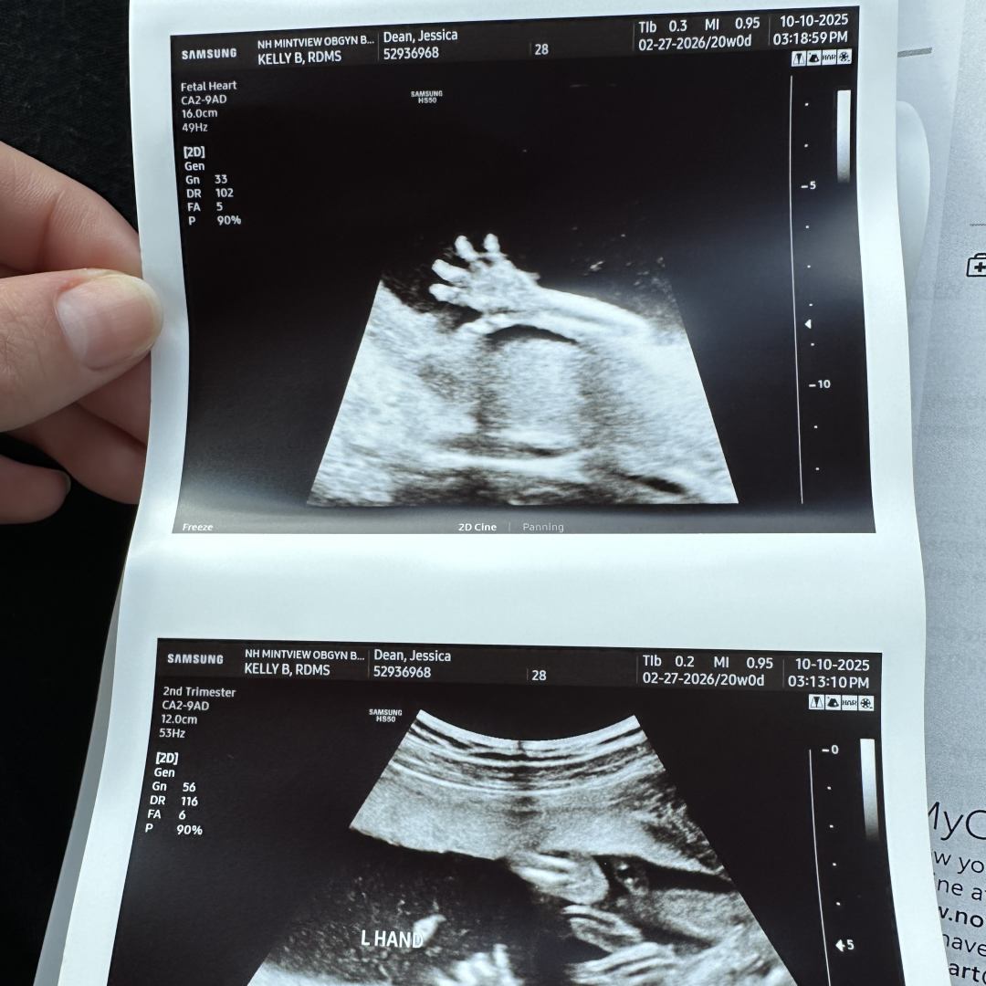 Photo shared by Taylor for their Babylist baby registry.