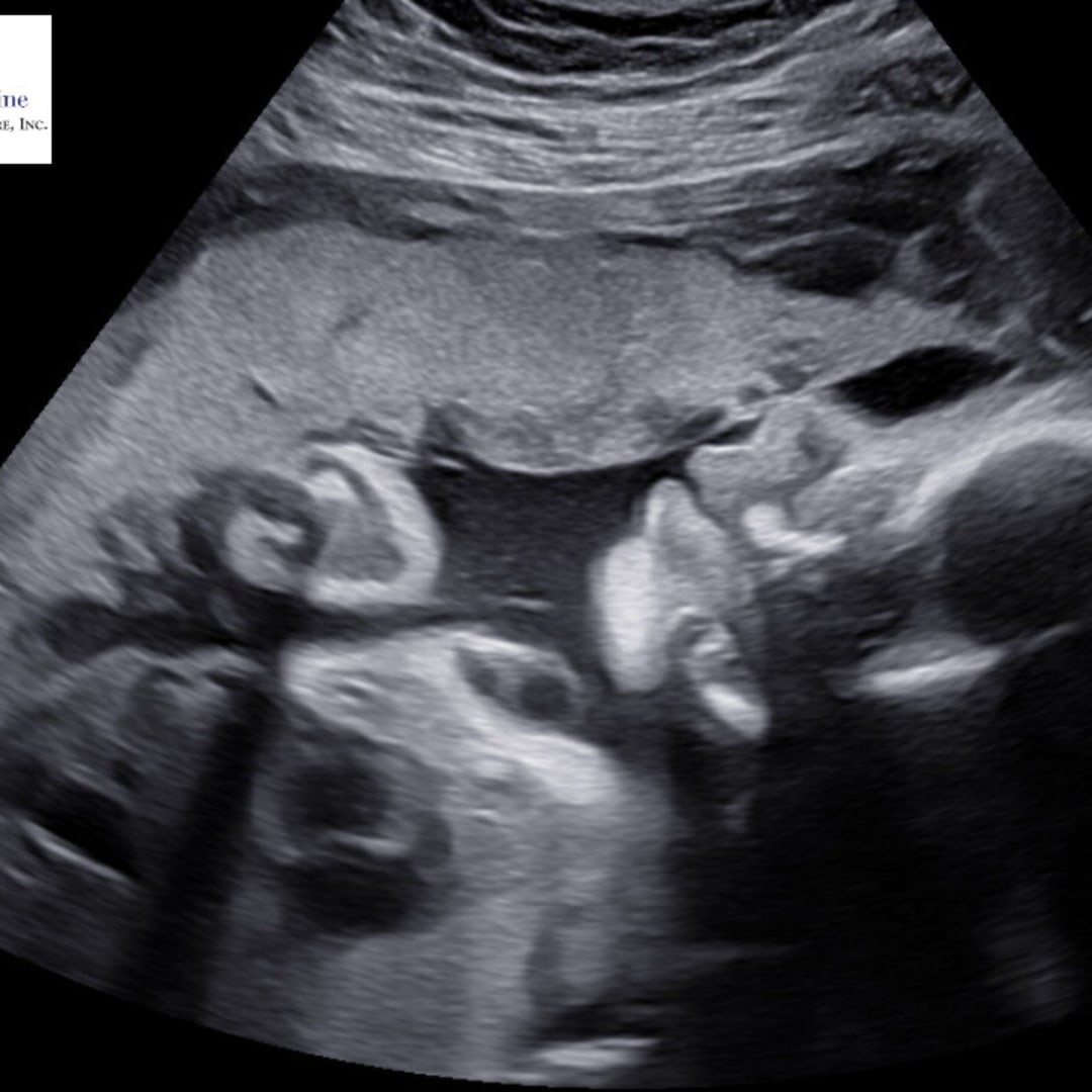 Photo shared by Allyson for their Babylist baby registry.