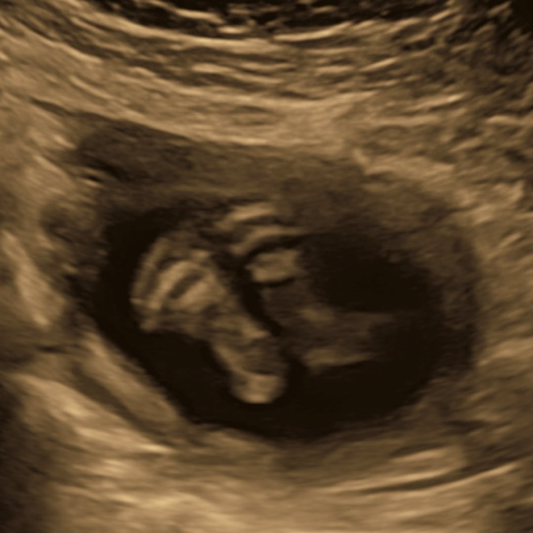 Photo shared by Evelyn for their Babylist baby registry.