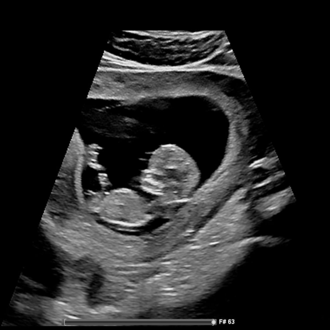 Photo shared by Abbie for their Babylist baby registry.