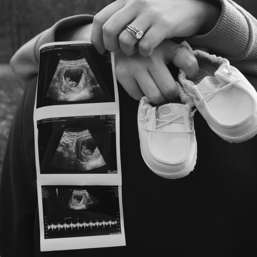 Photo shared by Erin for their Babylist baby registry.